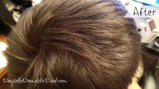 viviscal
viviscal mens review
does viviscal work for men
